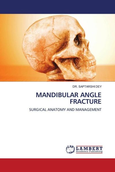 Produktbild: Mandibular Angle Fracture