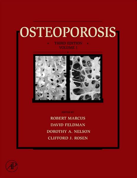 Produktbild: Osteoporosis