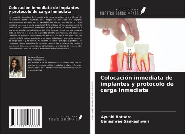 Produktbild: Colocaci&oacute;n inmediata de implantes y protocolo de carga inmediata