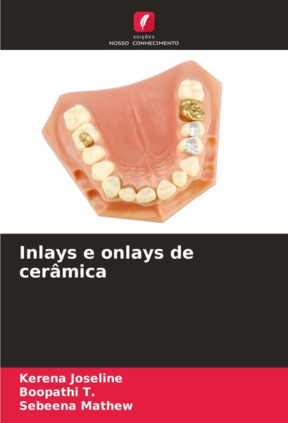 Produktbild: Inlays e onlays de cer&acirc;mica
