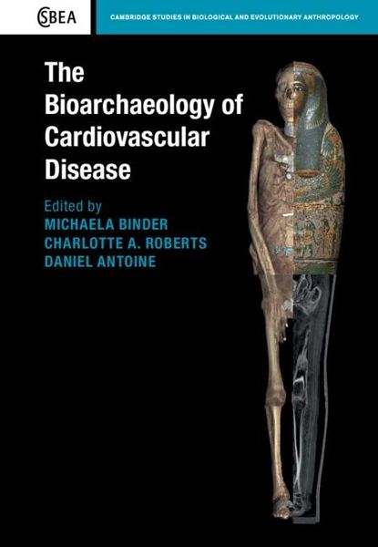 Produktbild: Bioarchaeology of Cardiovascular Disease