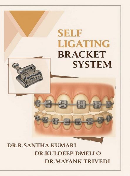 Produktbild: Self Ligating Bracket System