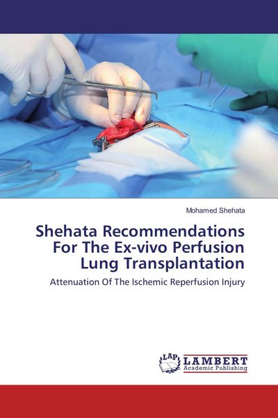Produktbild: Shehata Recommendations For The Ex-vivo Perfusion Lung Transplantation