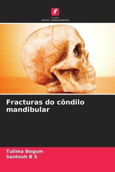 Produktbild: Fracturas do c&ocirc;ndilo mandibular