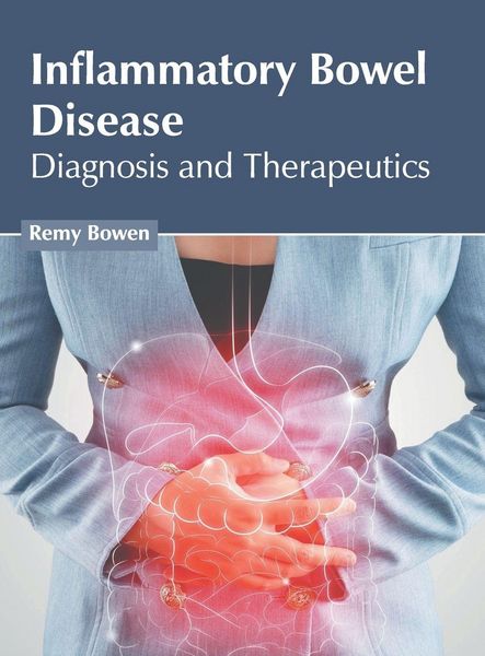 Produktbild: Inflammatory Bowel Disease: Diagnosis and Therapeutics