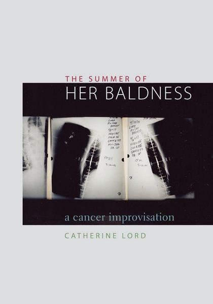 Produktbild: The Summer of Her Baldness