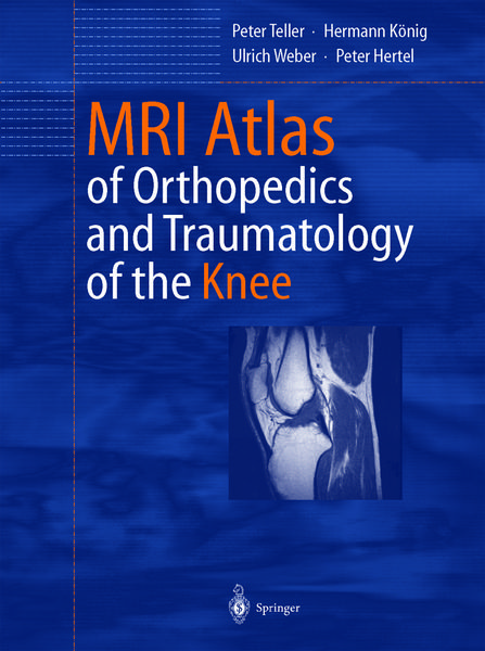 Produktbild: MRI Atlas of Orthopedics and Traumatology of the Knee