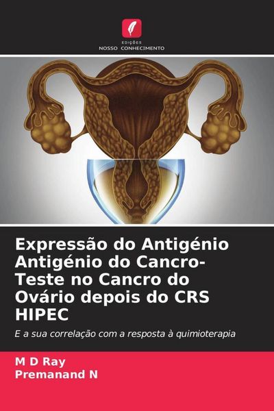 Produktbild: Express&atilde;o do Antig&eacute;nio Antig&eacute;nio do Cancro-Teste no Cancro do Ov&aacute;rio depois do CRS HIPEC