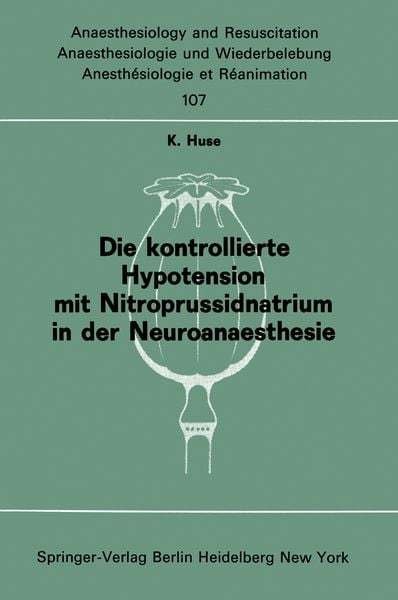 Produktbild: Die kontrollierte Hypotension mit Nitroprussidnatrium in der Neuroanaesthesie