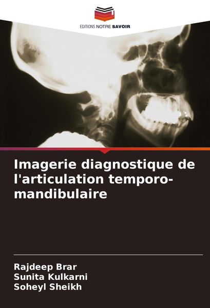 Produktbild: Imagerie diagnostique de l'articulation temporo-mandibulaire
