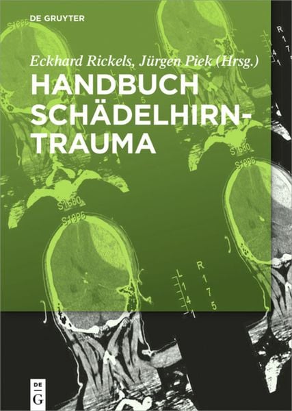 Handbuch Schädelhirntrauma, Gebundene Ausgabe von , De Gruyter, 9783110372342