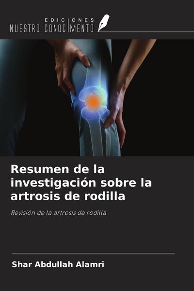 Produktbild: Resumen de la investigaci&oacute;n sobre la artrosis de rodilla