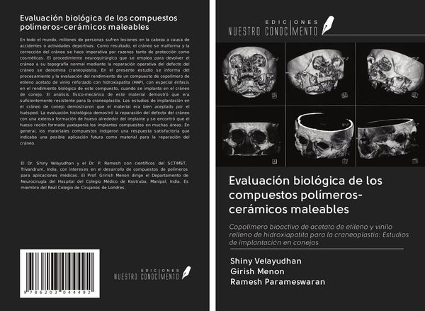 Produktbild: Evaluaci&oacute;n biol&oacute;gica de los compuestos pol&iacute;meros-cer&aacute;micos maleables