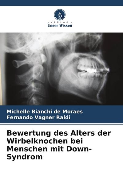 Produktbild: Bewertung des Alters der Wirbelknochen bei Menschen mit Down-Syndrom