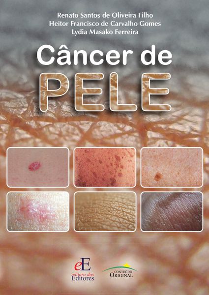 Produktbild: C&acirc;ncer de pele