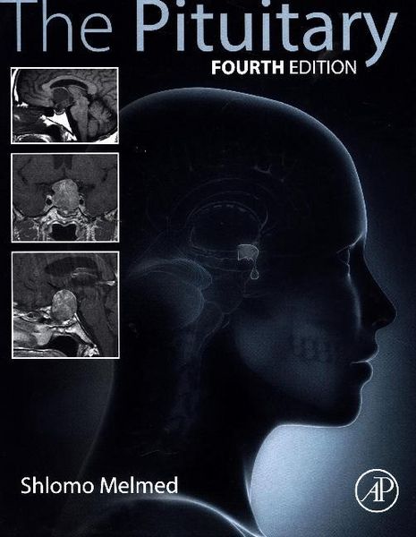 Produktbild: The Pituitary