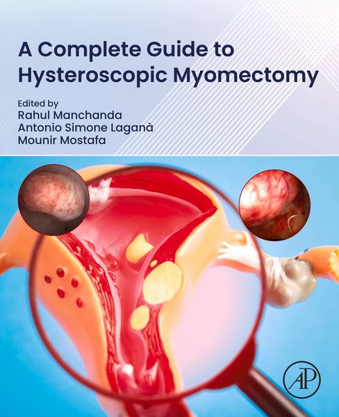 Produktbild: A Complete Guide to Hysteroscopic Myomectomy