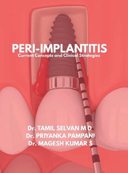 Produktbild: Peri-Implantitis