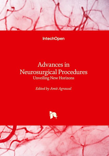 Produktbild: Advances in Neurosurgical Procedures - Unveiling New Horizons