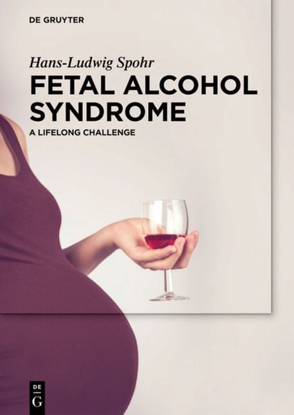Produktbild: Fetal Alcohol Syndrome