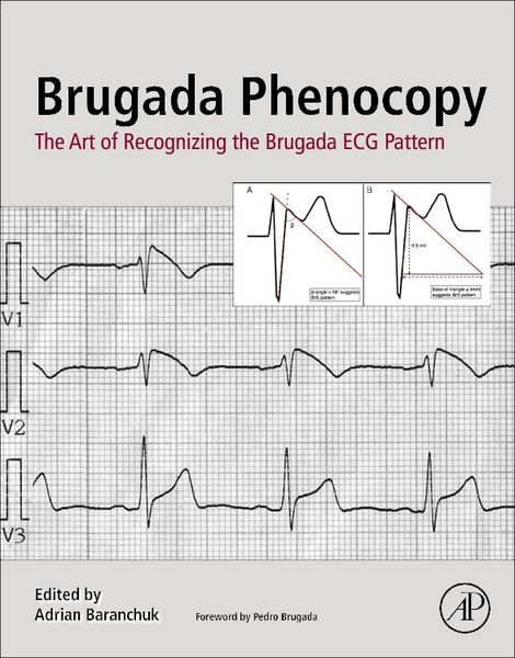 Produktbild: Brugada Phenocopy
