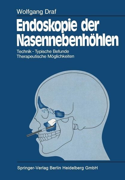 Produktbild: Endoskopie der Nasennebenh&ouml;hlen