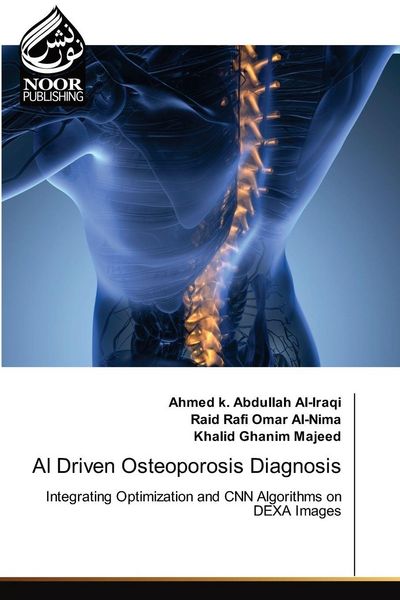 Produktbild: AI Driven Osteoporosis Diagnosis