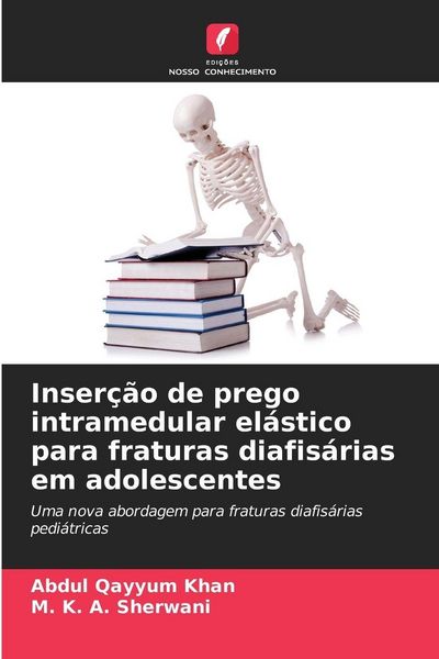 Produktbild: Inser&ccedil;&atilde;o de prego intramedular el&aacute;stico para fraturas diafis&aacute;rias em adolescentes