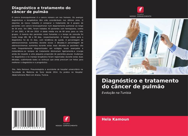 Produktbild: Diagn&oacute;stico e tratamento do c&acirc;ncer de pulm&atilde;o