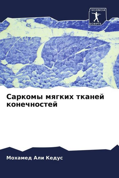 Produktbild: Sarkomy mqgkih tkanej konechnostej