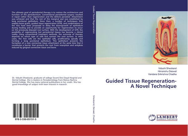 Produktbild: Guided Tissue Regeneration- A Novel Technique