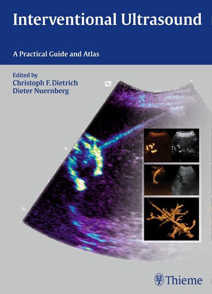Produktbild: Interventional Ultrasound