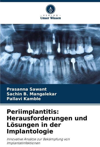 Produktbild: Periimplantitis: Herausforderungen und L&ouml;sungen in der Implantologie