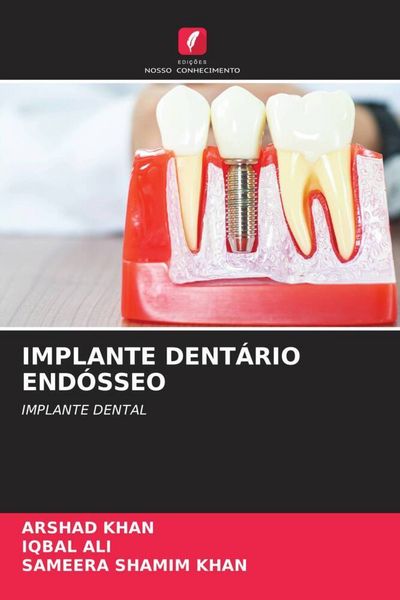 Produktbild: Implante Dent&aacute;rio End&oacute;sseo