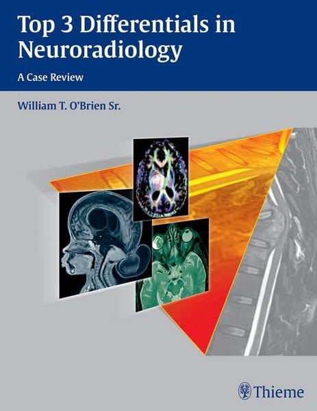 Produktbild: Top 3 Differentials in Neuroradiology