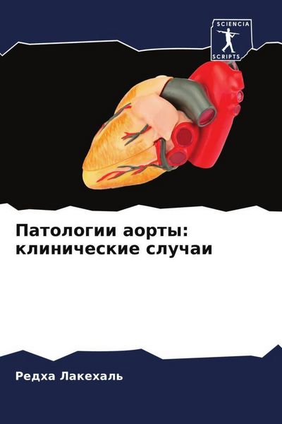 Produktbild: Patologii aorty: klinicheskie sluchai