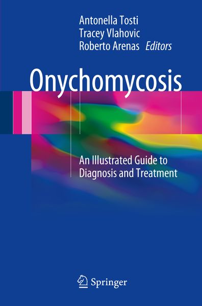 Produktbild: Onychomycosis