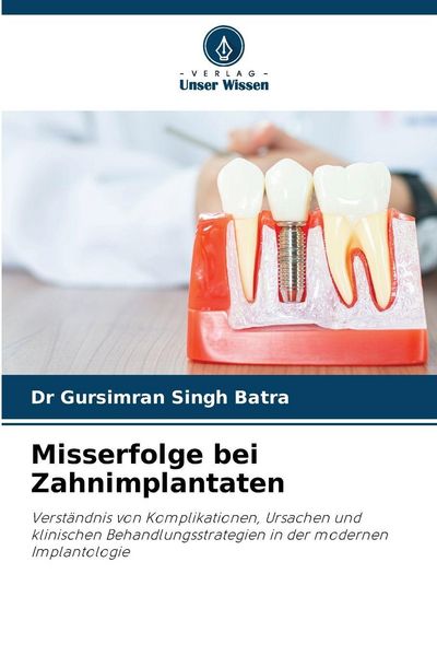 Misserfolge bei Zahnimplantaten, Taschenbuch von Gursimran Singh Batra, Verlag Unser Wissen, 9786202366625