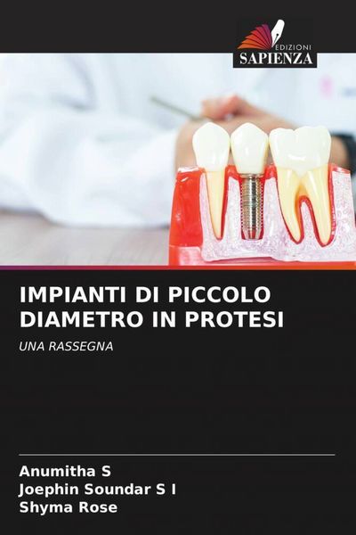 Produktbild: Impianti Di Piccolo Diametro in Protesi