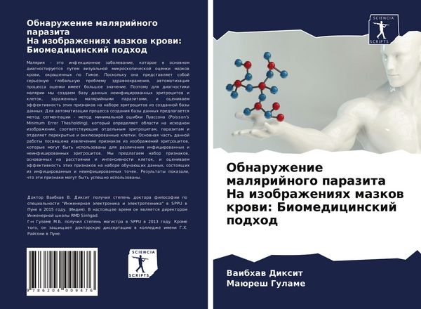 Produktbild: Obnaruzhenie malqrijnogo parazita Na izobrazheniqh mazkow krowi: Biomedicinskij podhod