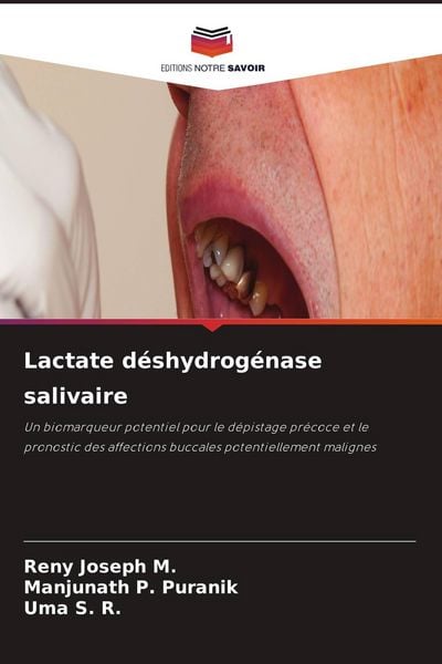 Produktbild: Lactate d&eacute;shydrog&eacute;nase salivaire