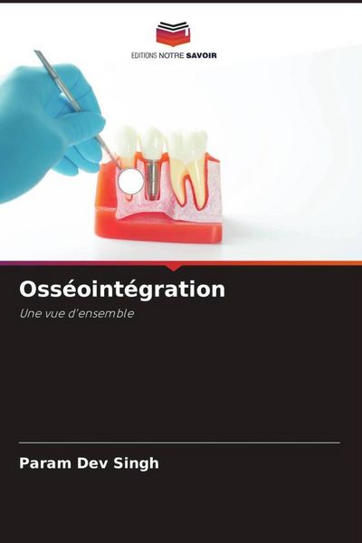 Produktbild: Oss&eacute;oint&eacute;gration