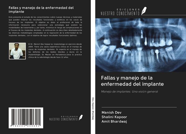 Produktbild: Fallas y manejo de la enfermedad del implante