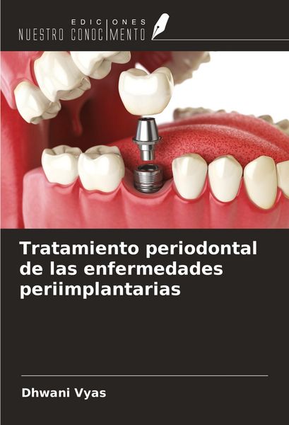 Produktbild: Tratamiento periodontal de las enfermedades periimplantarias