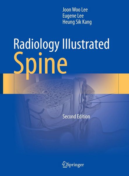 Produktbild: Radiology Illustrated: Spine