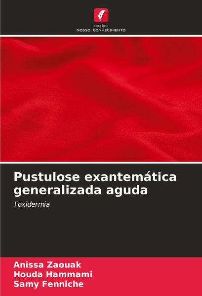 Produktbild: Pustulose exantem&aacute;tica generalizada aguda