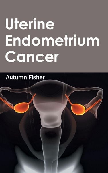 Produktbild: Uterine Endometrium Cancer