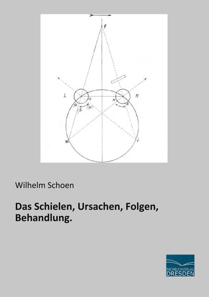 Produktbild: Das Schielen, Ursachen, Folgen, Behandlung.