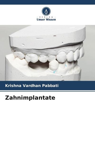 Zahnimplantate, Taschenbuch von Krishna Vardhan Pabbati, Verlag Unser Wissen, 9786205315002