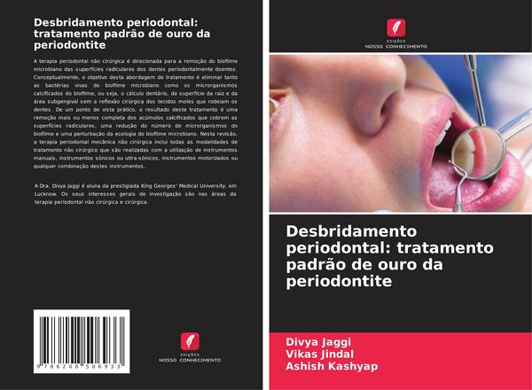Produktbild: Desbridamento periodontal: tratamento padr&atilde;o de ouro da periodontite